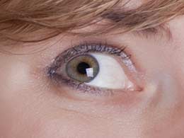Cataracts